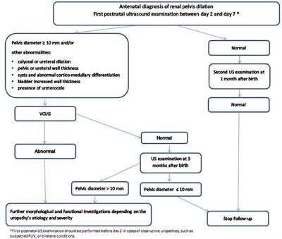 Clinical Outcome of Children With Antenatally Diagnosed Hydronephrosis